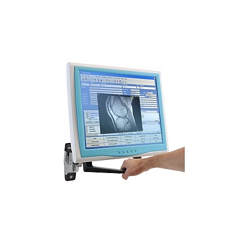 Monitor mit KnierÃ¶ntgenbild, von Hand gehalten.