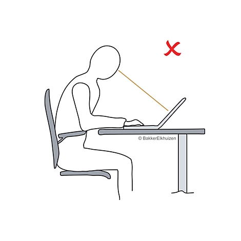 Illustration d'une mauvaise posture. Personne penchée sur un ordinateur portable, croix rouge au-dessus de la tête indiquant une posture incorrecte.