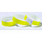 Trois bracelets d'identification en papier jaune fluo, disposés en léger décalé sur un fond blanc.