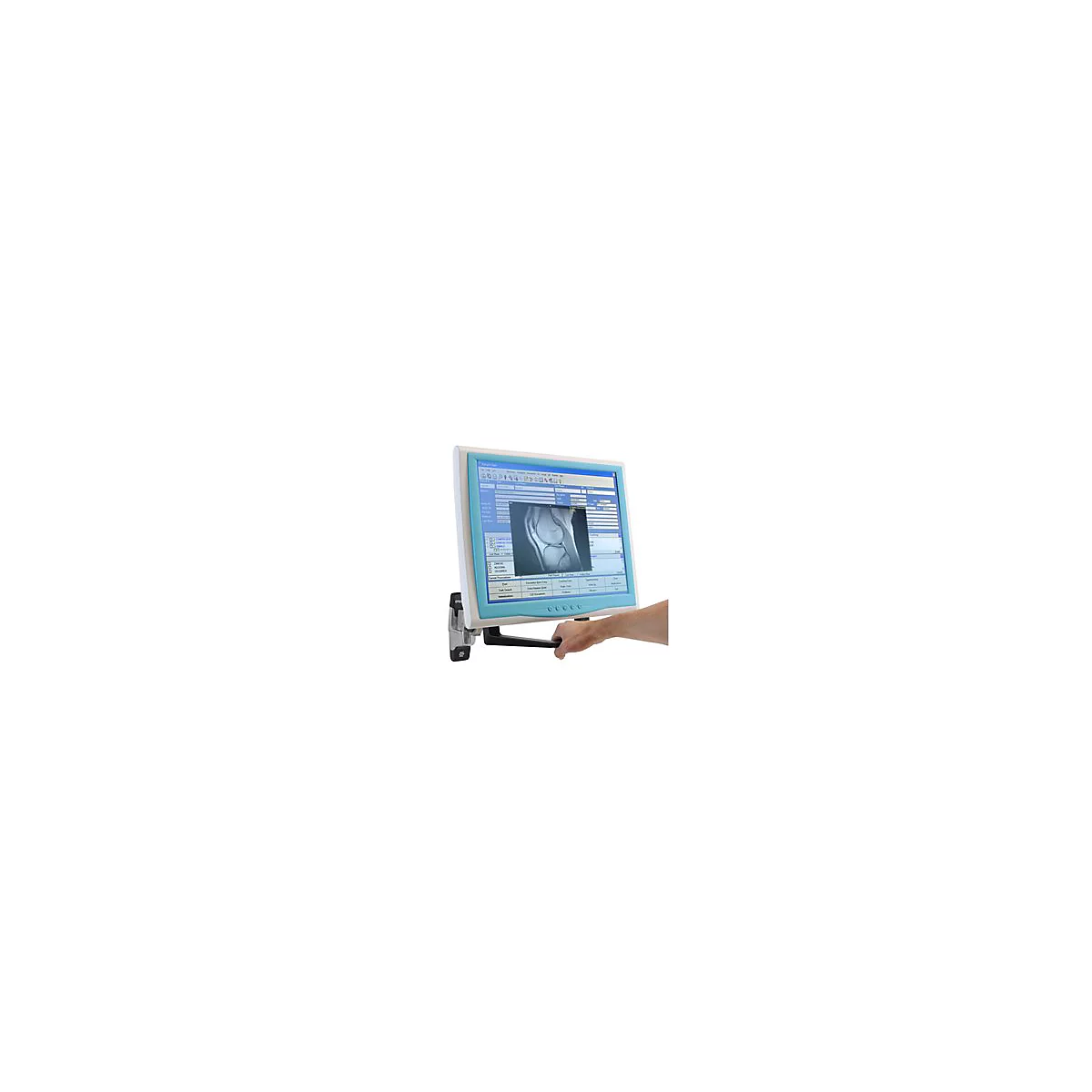Monitor mit KnierÃ¶ntgenbild, von Hand gehalten.