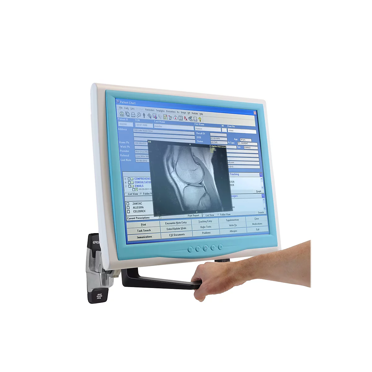Ergotron - Montagekomponente (Griff, Anschlussplatte) - für LCD-Display - Schwarz - Bildschirmgröße: bis zu 81,3 cm (bis zu 32 Zoll) - für P/N: 45-353-026, 45-475-216, 45-509-224, 45-630-224