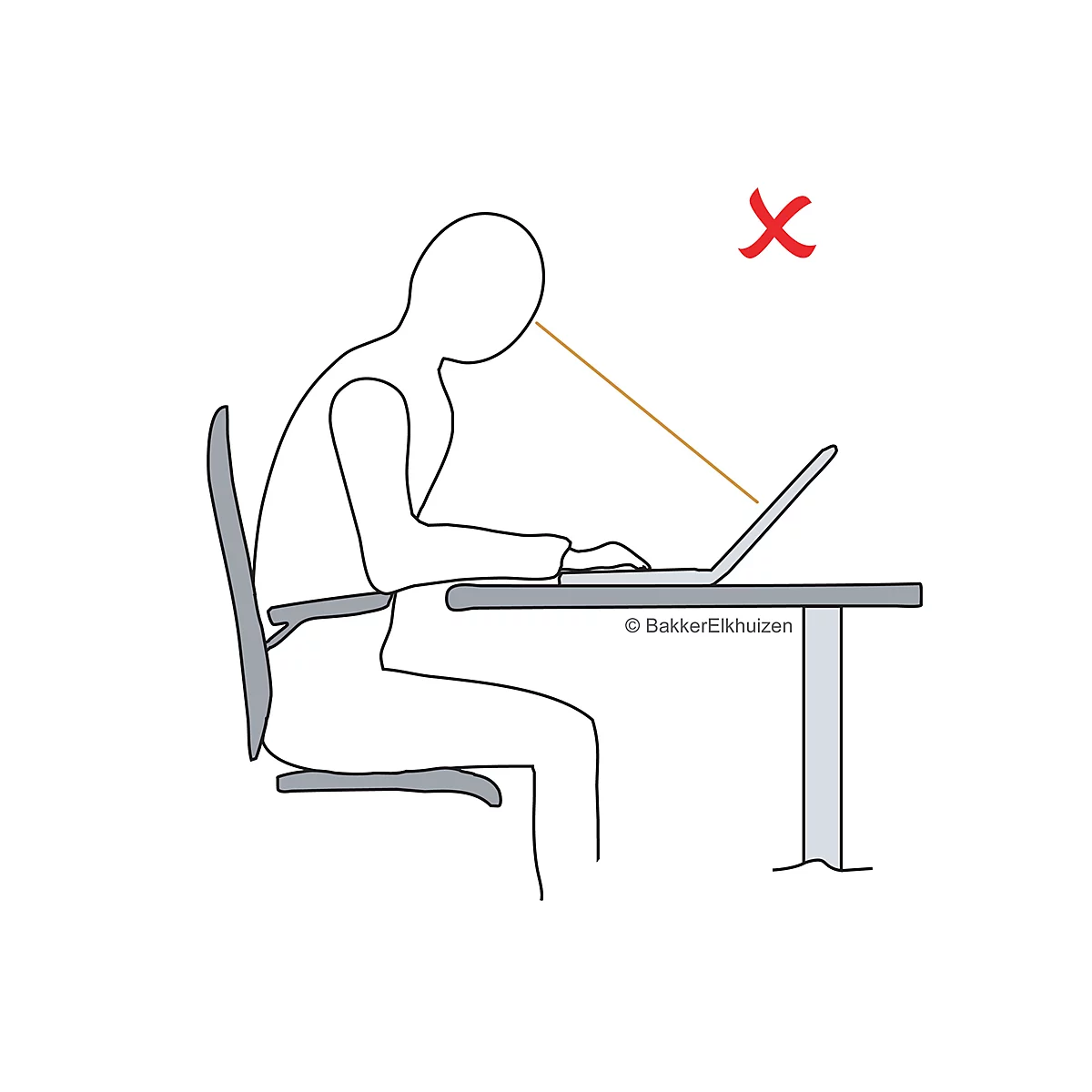 Illustration d'une mauvaise posture. Personne penchée sur un ordinateur portable, croix rouge au-dessus de la tête indiquant une posture incorrecte.